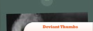 Deviant-Thumbs4.jpg